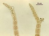 6 – Dettaglio delle porzioni apicali della fase tetrasporofitica